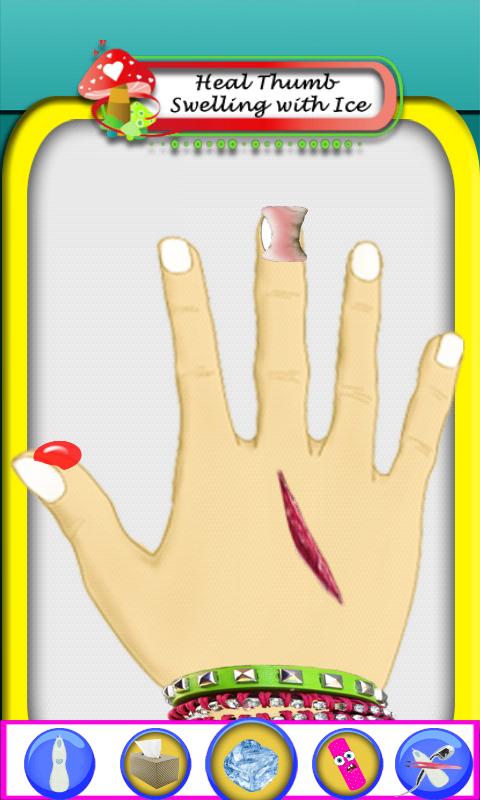 Hand Surgery