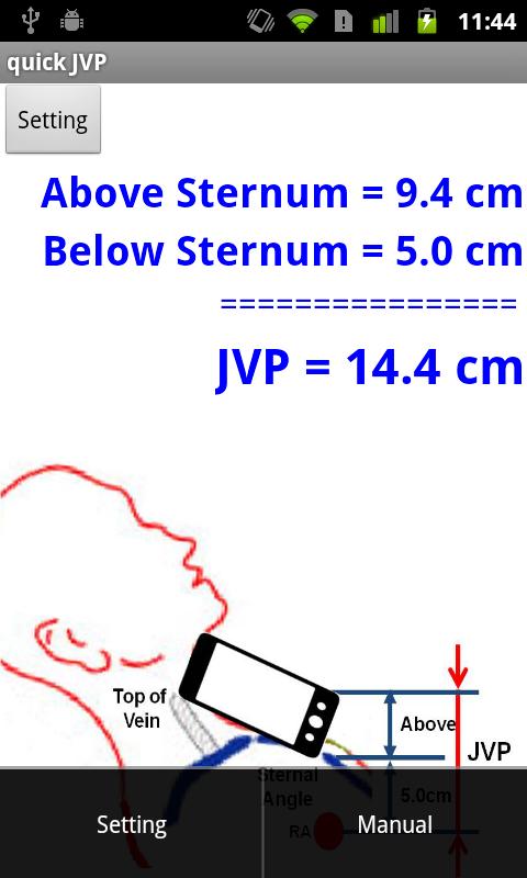 QuickJVP