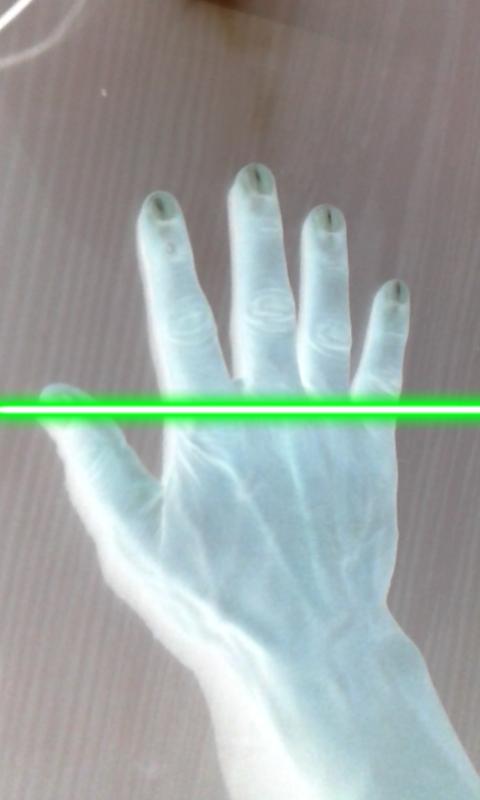 Ultrasound X Ray Scanner