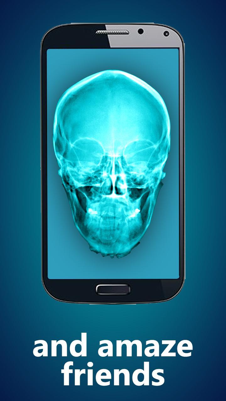 Xray Prank